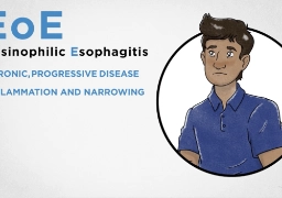 EoE Support & Resources | Understand EoE